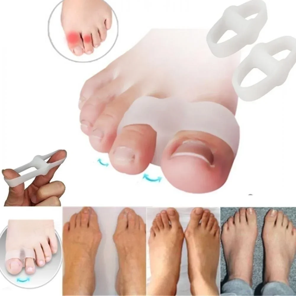2개의 구멍 Bunion 교정기 통증 완화 발가락 분리 - Correction Fluid White 리뷰 및 가격